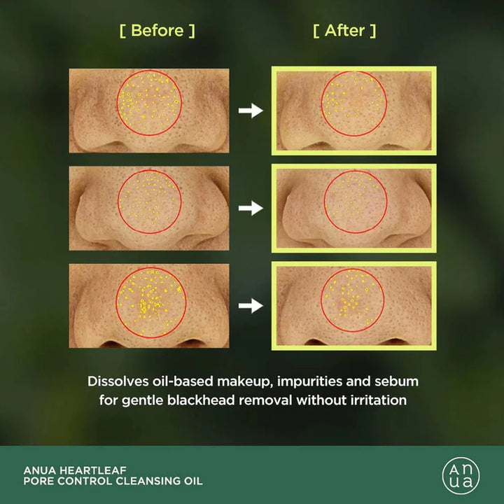 Texture of oil on skin before emulsifying