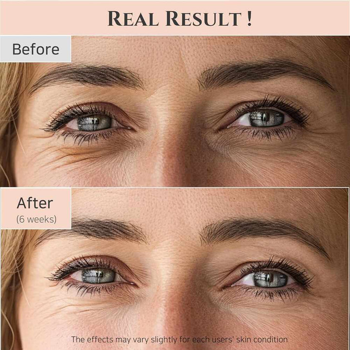 Before/after usage result (if provided) or packaging detail – eye serum