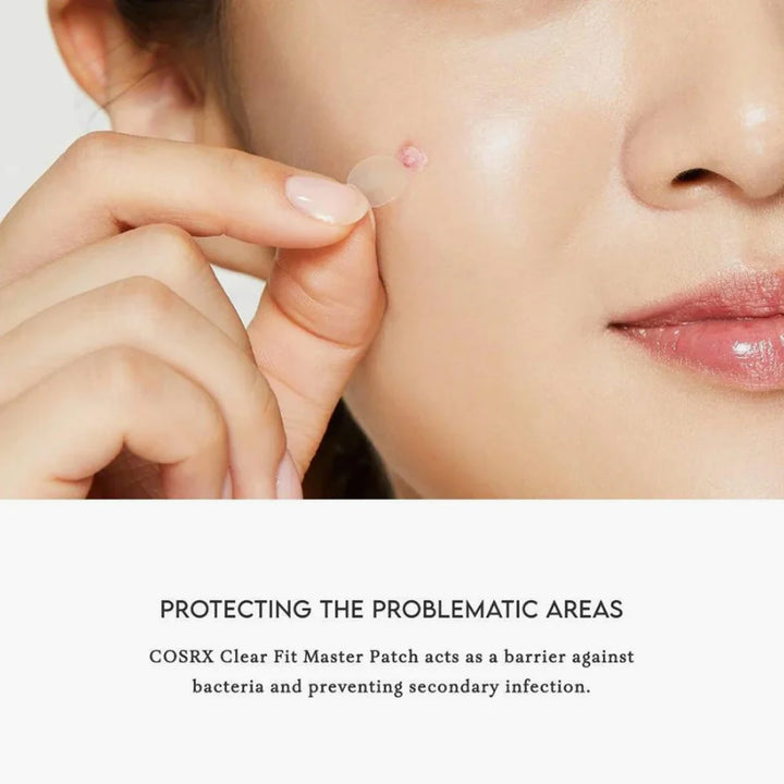 Close-up of applying COSRX acne patch on a blemish.