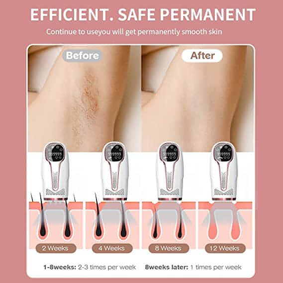 ICE Cool IPL Laser Hair Removal Device With 1 Million Flashes With Auto Features