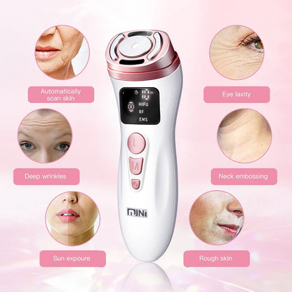 Hifu Anti Wrinkle Device